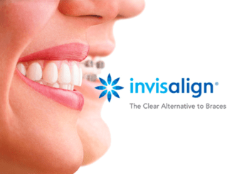 invisalign